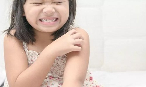 Skin rashes in babies